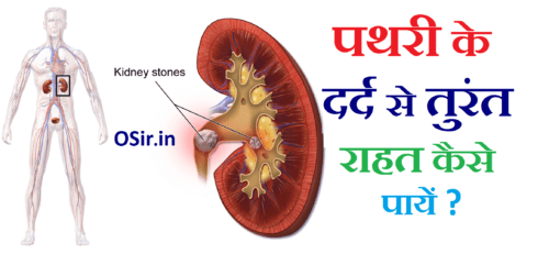 तुरंत पथरी के दर्द कम करने के 5 घरेलू उपाय | पथरी के दर्द से तुरंत राहत | kidney stone ka dard