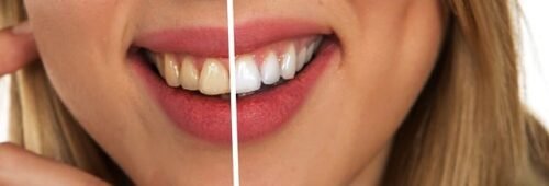 Teeth
