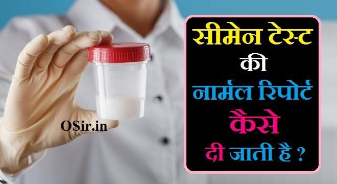 सीमेन एनालिसिस टेस्ट रिपोर्ट, सीमेन एनालिसिस टेस्ट in Hindi, सीमेन एनालिसिस टेस्ट कैसे होता है, सीमेन एनालिसिस टेस्ट in english, सीमेन एनालिसिस टेस्ट cost, सीमेन टेस्ट किट, सीमेन कल्चर टेस्ट रिपोर्ट इन हिंदी, सीमेन एनालिसिस टेस्ट near me, सीमेन टेस्ट की नार्मल रिपोर्ट, सीमेन टेस्ट की नार्मल रिपोर्ट hindi, सीमेन टेस्ट नार्मल रिपोर्ट इन हिंदी, सीमेन टेस्ट नार्मल रिपोर्ट, sperm count सीमेन टेस्ट की नार्मल रिपोर्ट, सीमेन एनालिसिस टेस्ट नार्मल रिपोर्ट, seman test ki normal report hindi, seman test ki normal report image, seman test ki normal report pdf, सीमेन टेस्ट की नार्मल रिपोर्ट, सीमेन टेस्ट की नार्मल रिपोर्ट hindi, सीमेन टेस्ट नार्मल रिपोर्ट इन हिंदी, सीमेन टेस्ट नार्मल रिपोर्ट, sperm count सीमेन टेस्ट की नार्मल रिपोर्ट, सीमेन एनालिसिस टेस्ट नार्मल रिपोर्ट, गर्भावस्था में प्रसव पूर्व स्वास्थ्य जांच, अल्ट्रासाउंड कितने प्रकार का होता है in English, क्या प्रेगनेंसी किट सही बताता है, नमक से प्रेगनेंसी टेस्ट, बच्चेदानी का अल्ट्रासाउंड कैसे होता है, अल्ट्रासोनोग्राफी के उपयोग, अल्ट्रासोनोग्राफी क्या है, प्रसव पूर्व देखभाल के उद्देश्यसीमेन टेस्ट की नार्मल रिपोर्ट, सीमेन टेस्ट की नार्मल रिपोर्ट hindi, सीमेन टेस्ट नार्मल रिपोर्ट इन हिंदी, सीमेन टेस्ट नार्मल रिपोर्ट, sperm count सीमेन टेस्ट की नार्मल रिपोर्ट, सीमेन एनालिसिस टेस्ट नार्मल रिपोर्ट, सीमेन टेस्ट की नार्मल रिपोर्ट, सीमेन एनालिसिस टेस्ट कैसे होता है, सीमेन एनालिसिस टेस्ट in Hindi, सीमेन एनालिसिस टेस्ट रिपोर्ट, सीमेन एनालिसिस टेस्ट price, सीमेन कल्चर टेस्ट रिपोर्ट इन हिंदी, शुक्राणु की कमी के लक्षण, स्पर्म मोटिलिटी रेंज चार्ट, seman test ki normal report hindi, seman test ki normal report image, seman test ki normal report hindi, seman test ki normal report image, seman test ki normal report hindi, what is normal sperm report, what should normal sperm count be, normal sperm count in male in hindi, what is normal sperm quality, how to check sperm test report, seman test ki normal report pdf, seman test normal report in hindi, seman+test+ki+normal+report, seman test ki normal report, seman test ki normal report image, seman test ki normal report in hindi, what is the normal range of sperm, , , , , , , , , seman test ki normal report pdf,