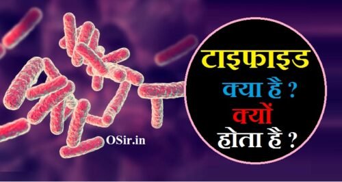 Typhoid ke lakshan : टाइफाइड होने के करण व 10 लक्षण | टाइफाइड क्या है क्यों होता है डिटेल जानकारी pdf