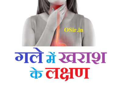 गले में खराश क्यों और उसके लक्षण,कारण और निवारण एवं जरुरी परहेज | गले में खराश :  Gale Me Kharash