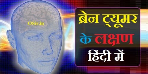 ​ब्रेन ट्यूमर के लक्षण और इलाज एवं ब्रेन ट्यूमर के प्रकार | brain tumor ke lakshan in hindi