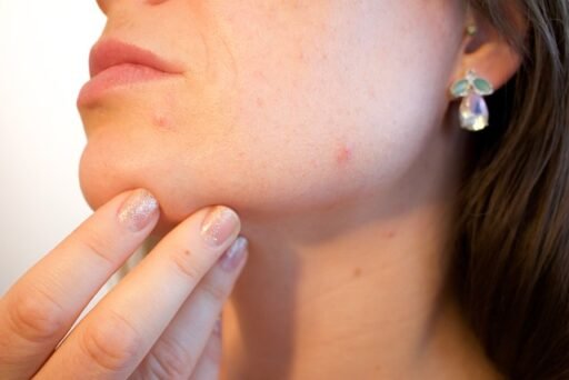 skin infection